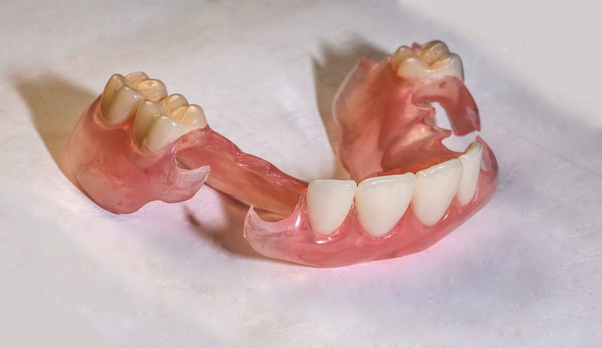 difference-between-cast-partial-denture-and-removable-partial-denture